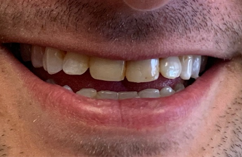 Before cosmetic treatment