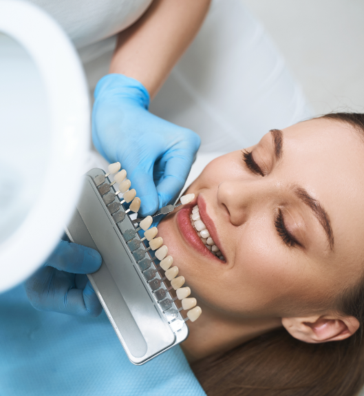 Image of tooth veneer