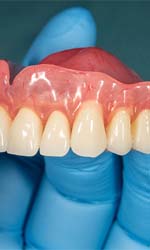 full denture showing how customized dentures in Studio City are