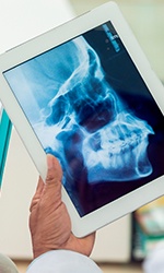 X-ray of jaw and skull bone