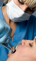 Dentist removing tooth from patient’s mouth