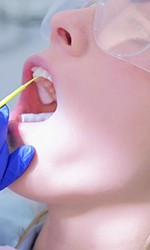 Fluoride is applied to a patient’s teeth