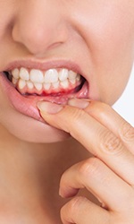Person with red, inflamed gums