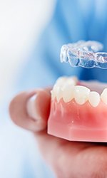 Up-close image of dentist placing Invisalign aligner on mouth mold