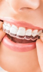 Woman using clear aligner