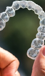 Closeup of clear aligner