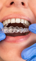 Woman getting Invisalign