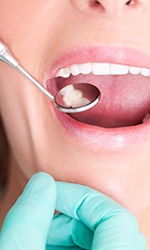 Closeup of smile during dental exam