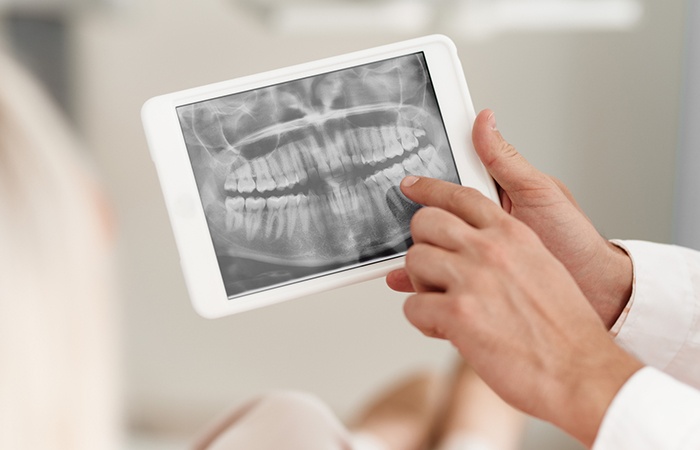 Digital x-rays on tablet computer