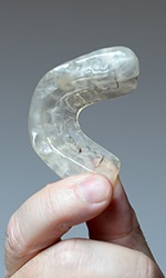 Hand holding clear oral appliance