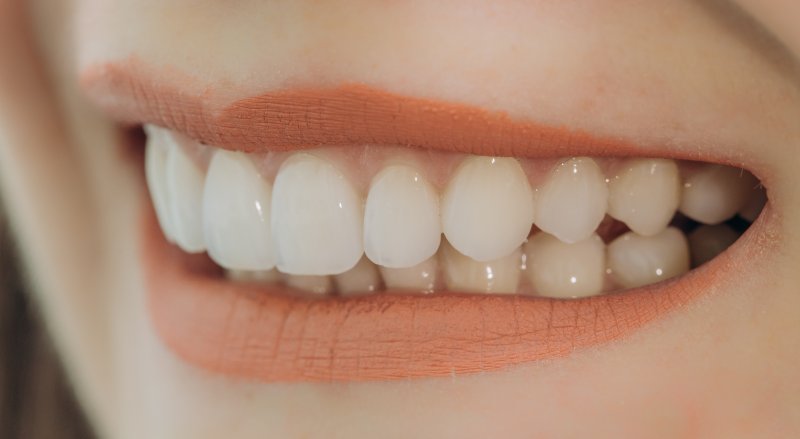 Woman after teeth whitening in Studio City