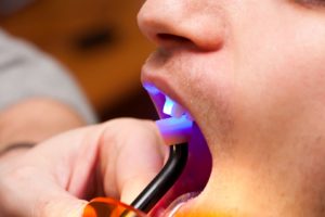 Man undergoing dental bonding procedure